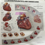 Cardiovascular Disease Chart
