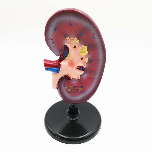 Plastic Kidney Model